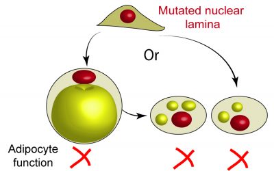 Chromatin architecture in lipodystrophic laminopathies